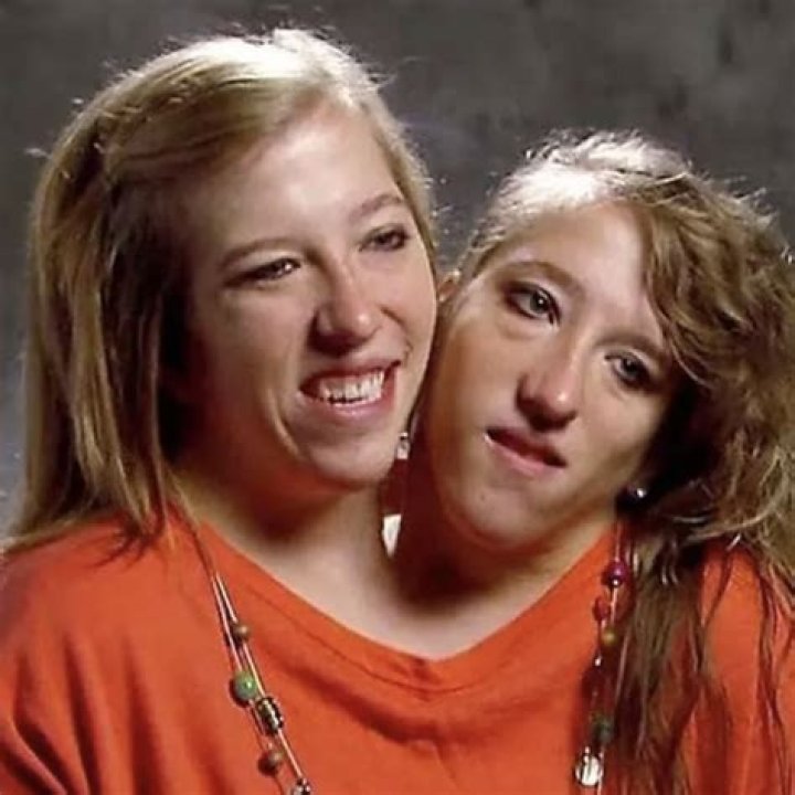 Incredible Conjoined Twins: Abby And Brittany Hensel's Journey In 2020