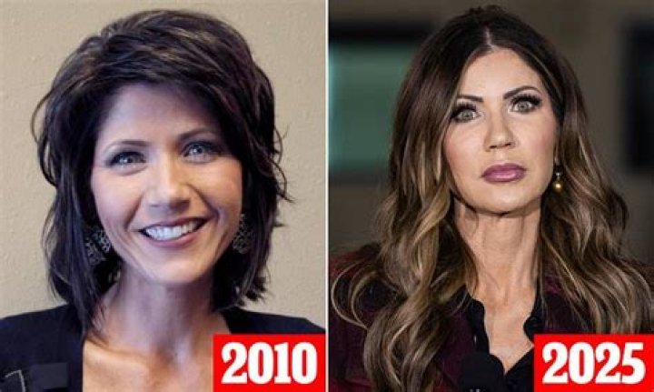 The Truth Behind Kristi Noem's Plastic Surgery Rumors