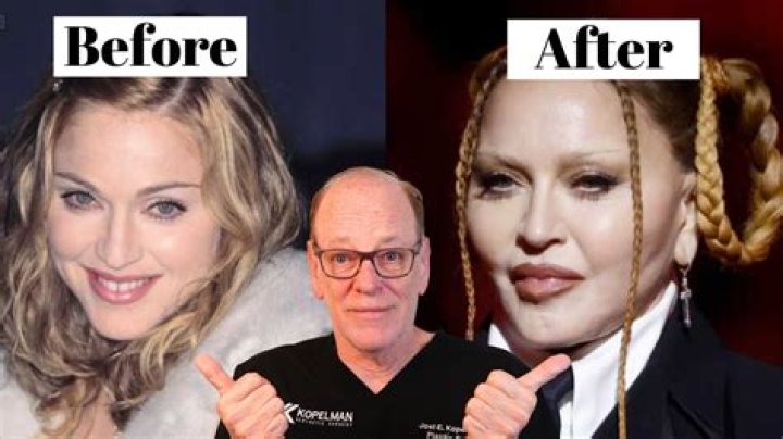 Ultimate Guide To Kim Guilfoyle's Plastic Surgery Transformation