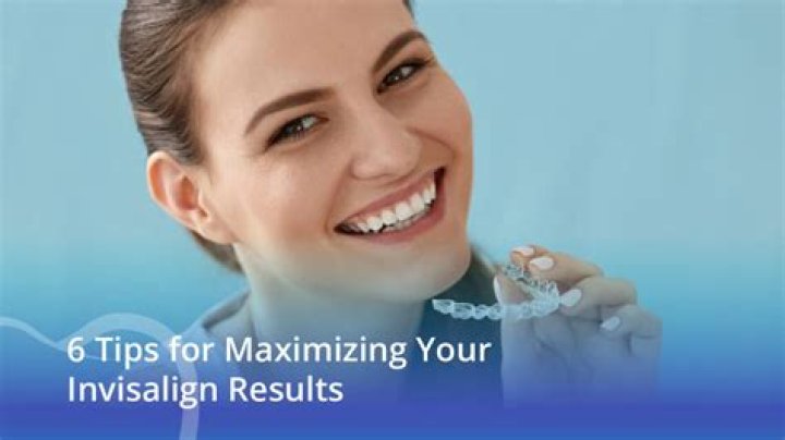 Ultimate Guide To Maximizing Your Smile: Tips From Max Smiley