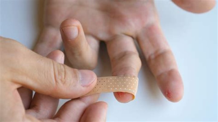 Understanding The Significance Of Bandage-Covered Fingers In Eating Disorders